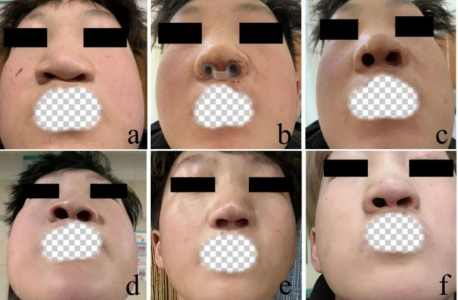 1763000995385196.png image.png